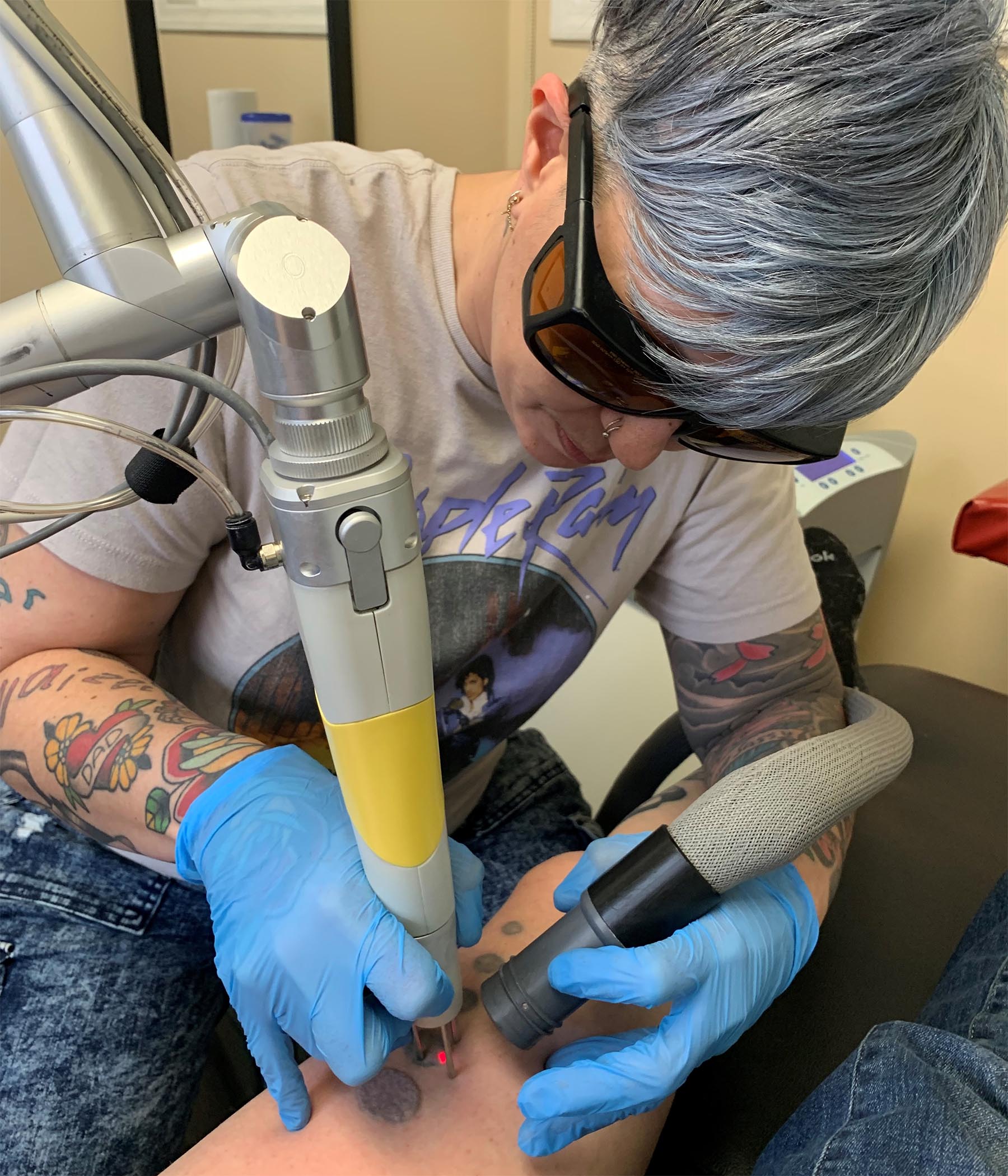 New Skin Laser Tattoo Removal – Victoria, BC – Tattoo Removal in Victoria,  British Columbia, by Pete McKay at Urge Studios